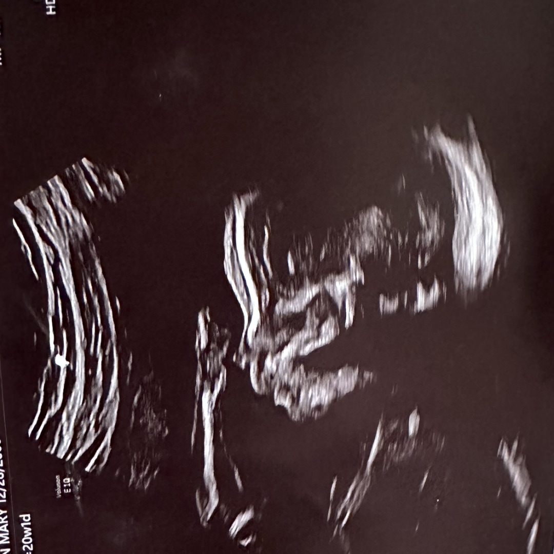 Photo shared by Kathryn for their Babylist baby registry.