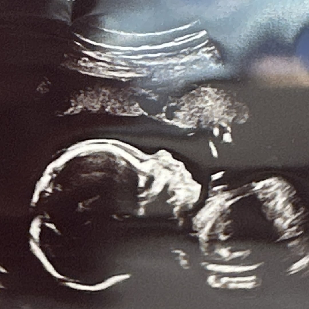 Photo shared by Jaden for their Babylist baby registry.