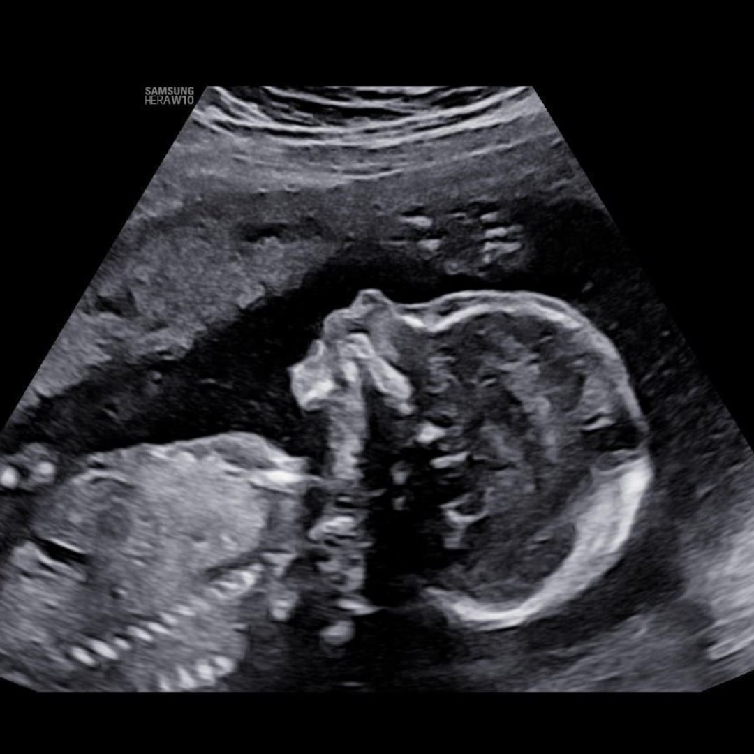 Photo shared by Kayla for their Babylist baby registry.
