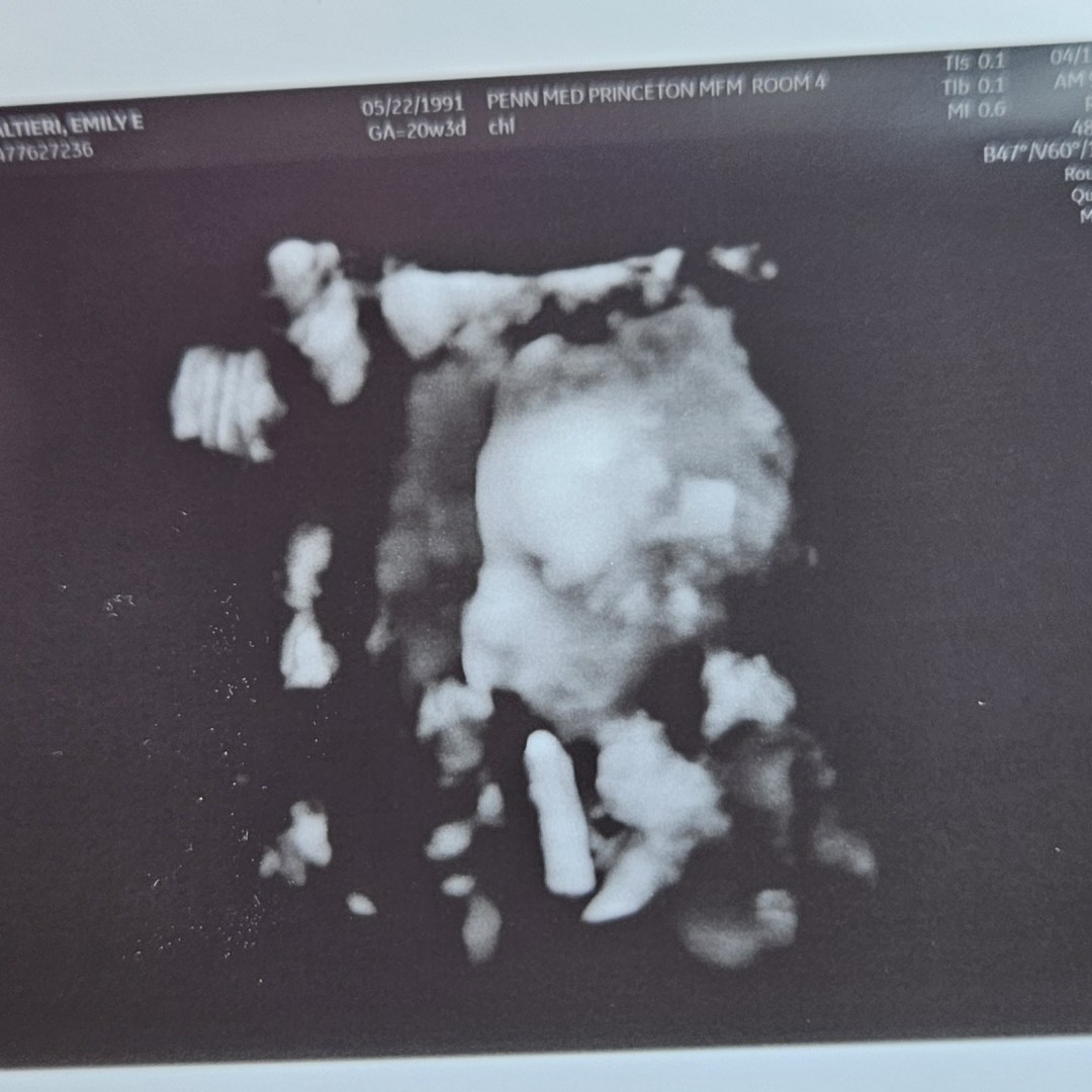 Photo shared by Emily for their Babylist baby registry.