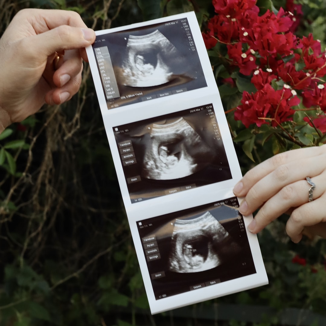 Photo shared by Rebecca for their Babylist baby registry.