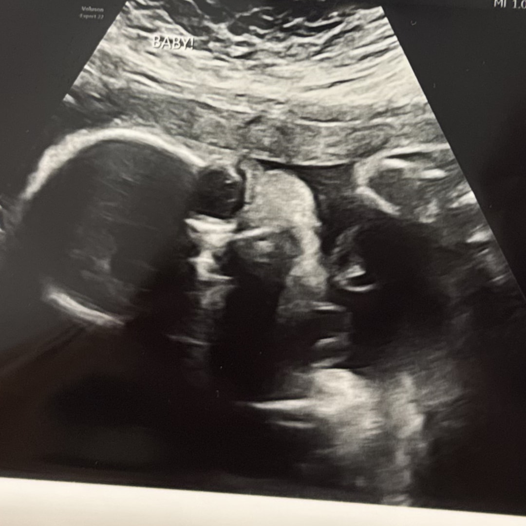 Photo shared by Madison for their Babylist baby registry.