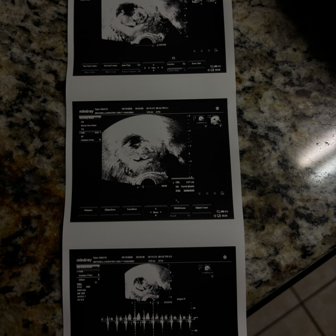 Photo shared by Kiersten for their Babylist baby registry.