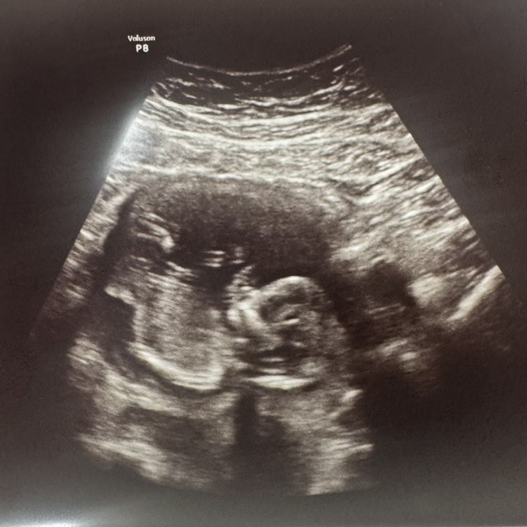 Photo shared by Haylee for their Babylist baby registry.