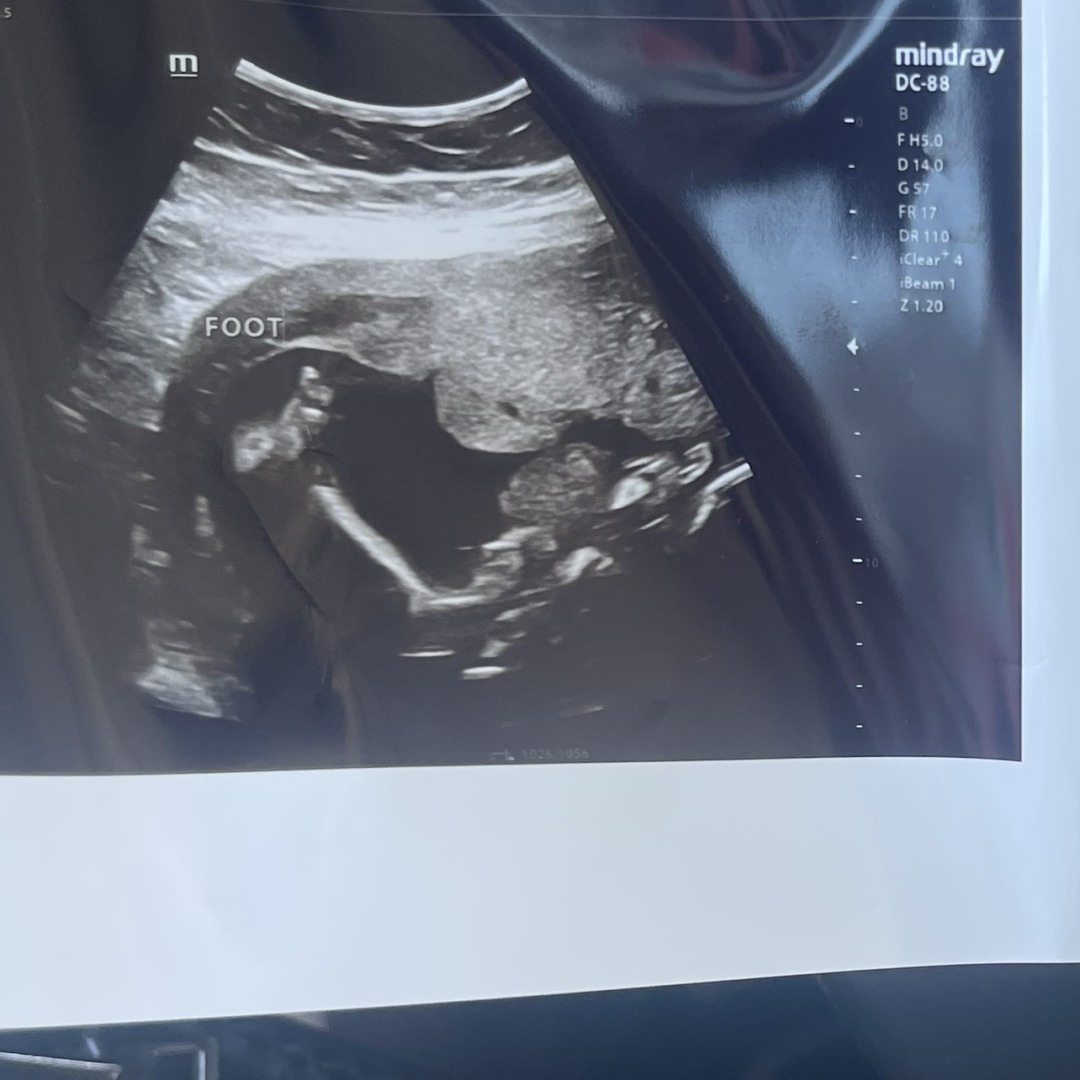 Photo shared by Harley for their Babylist baby registry.