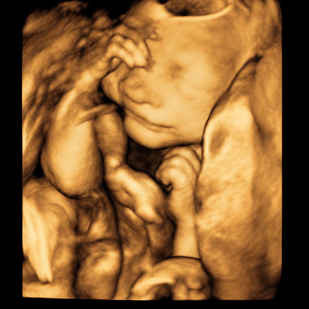 Photo shared by Marissa for their Babylist baby registry.