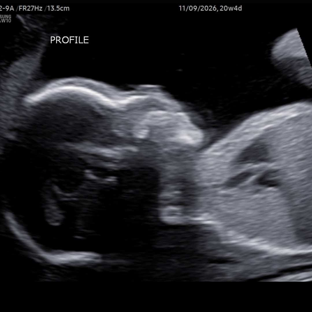 Photo shared by Anna for their Babylist baby registry.