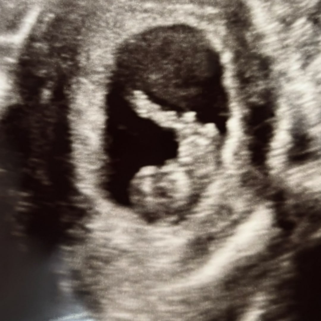Photo shared by Taylor for their Babylist baby registry.