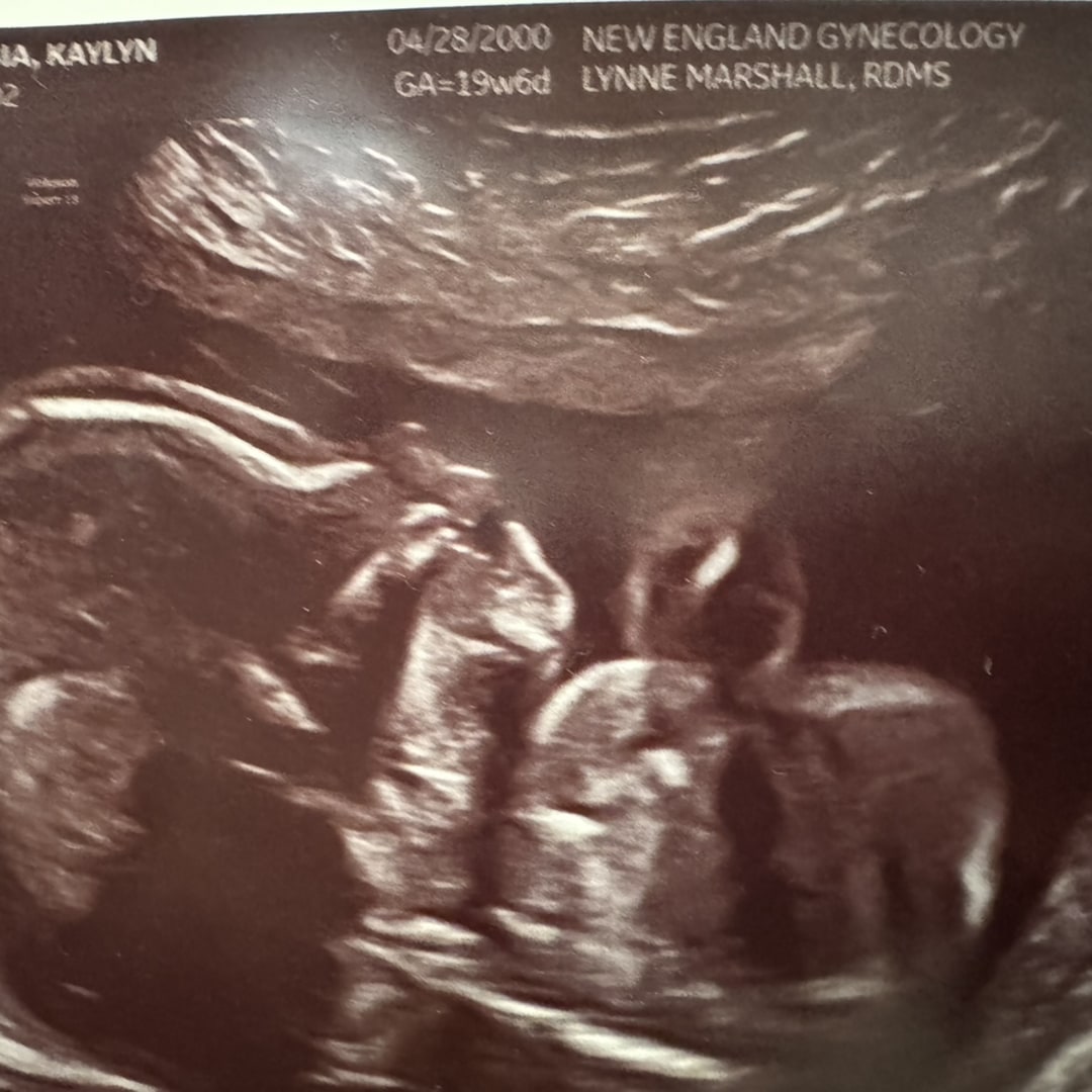 Photo shared by Kaylyn for their Babylist baby registry.