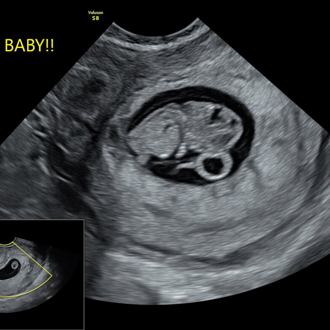 Photo shared by Hannah for their Babylist baby registry.