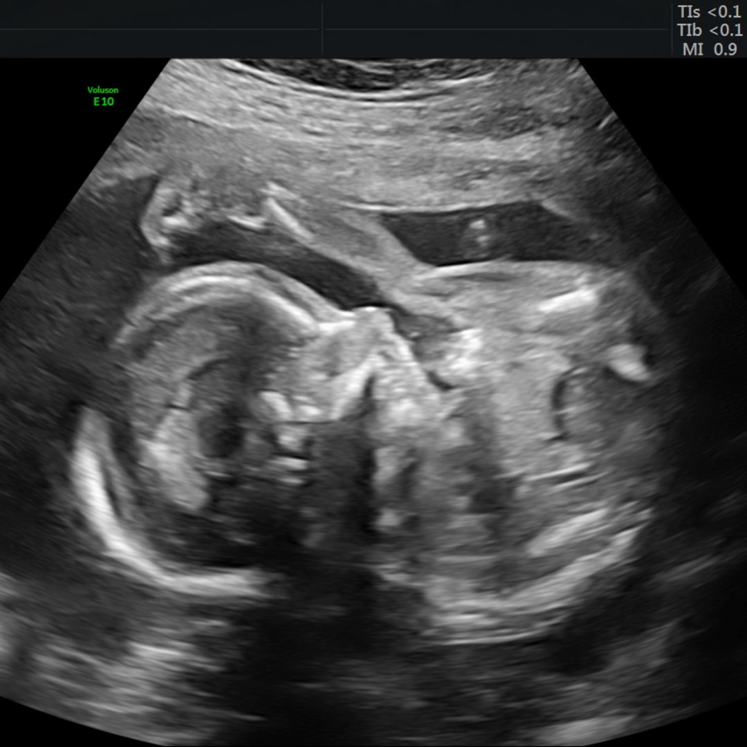 Photo shared by Hannah for their Babylist baby registry.