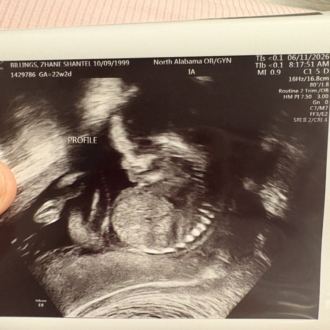 Photo shared by Zhane for their Babylist baby registry.
