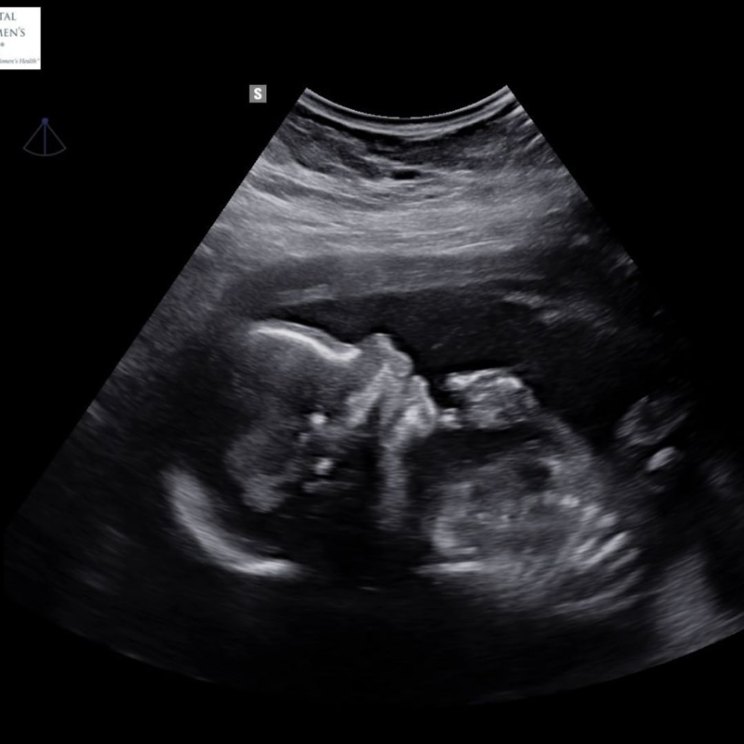 Photo shared by Hannah for their Babylist baby registry.