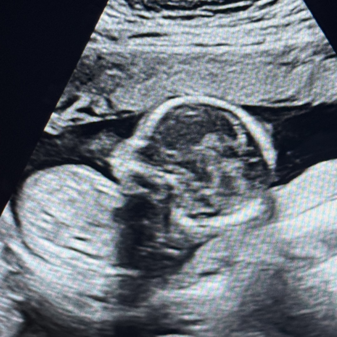 Photo shared by Michaela for their Babylist baby registry.