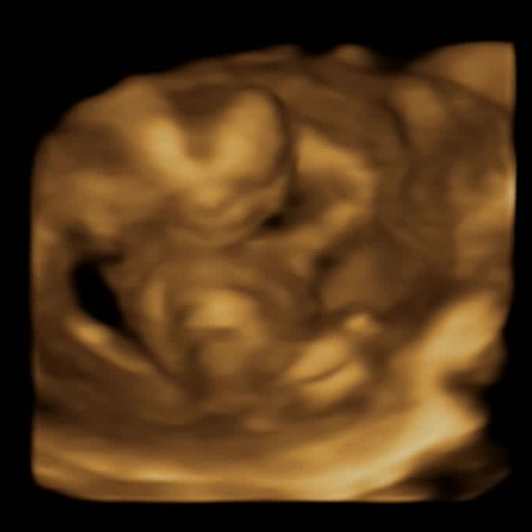 Photo shared by Kaitlyn for their Babylist baby registry.