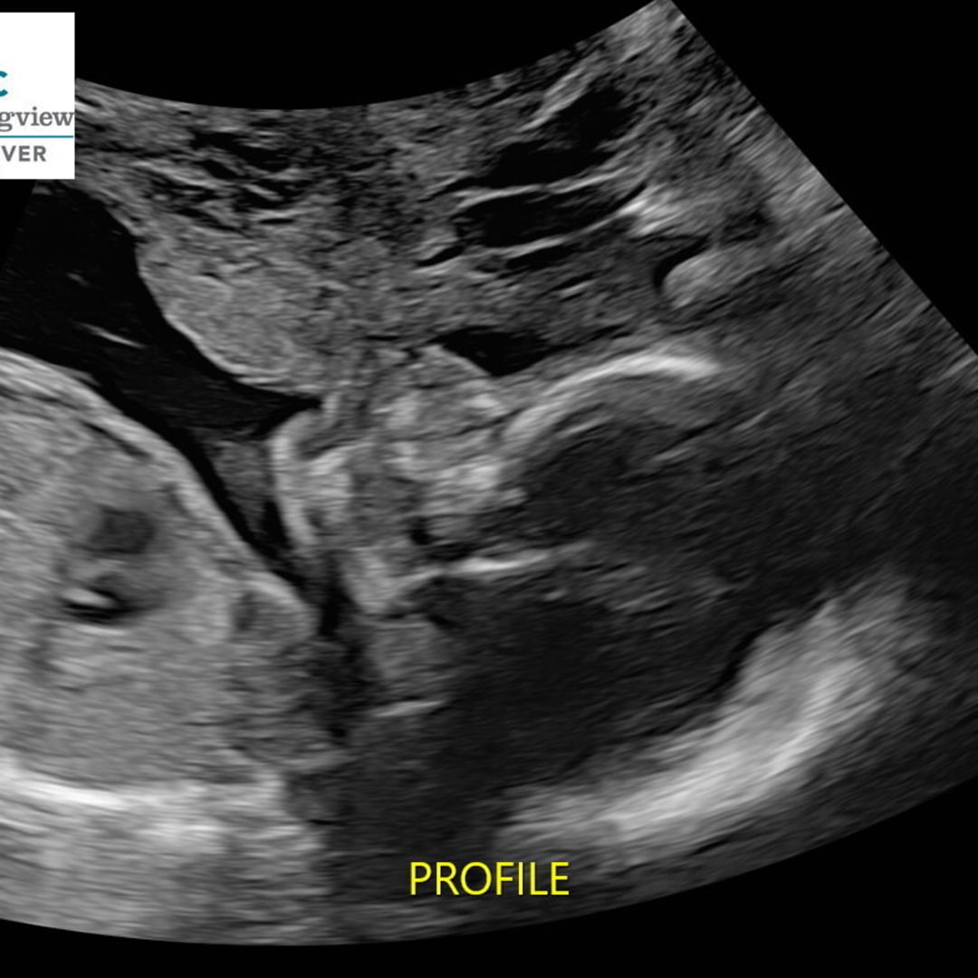 Photo shared by Tyler for their Babylist baby registry.