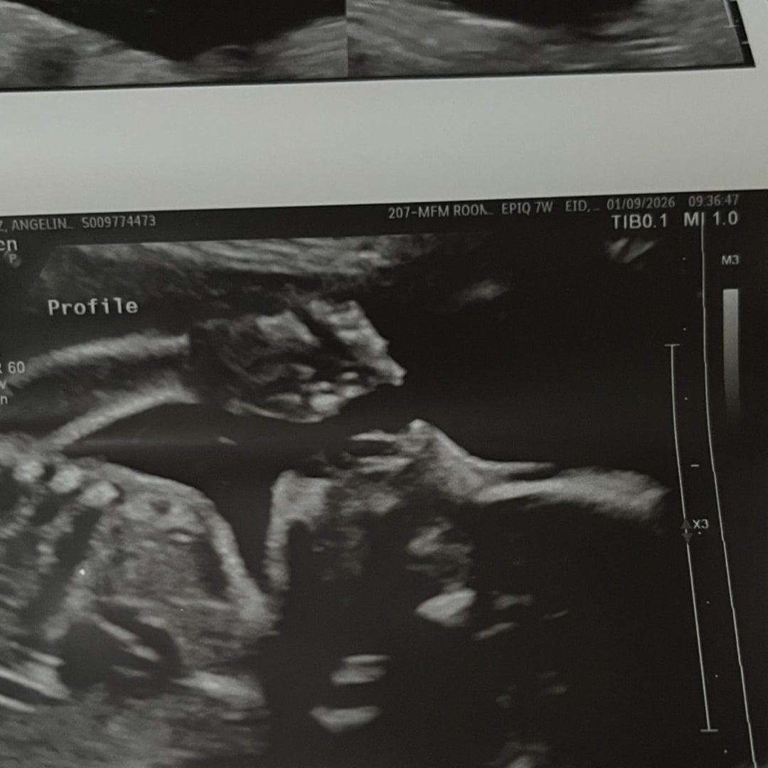 Photo shared by Angelinajollie for their Babylist baby registry.