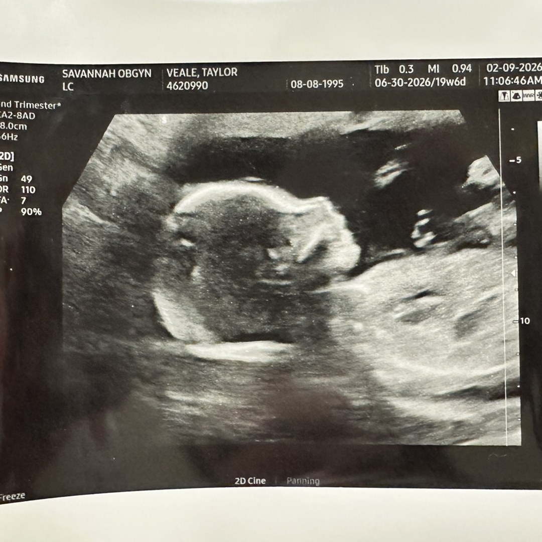 Photo shared by Taylor for their Babylist baby registry.