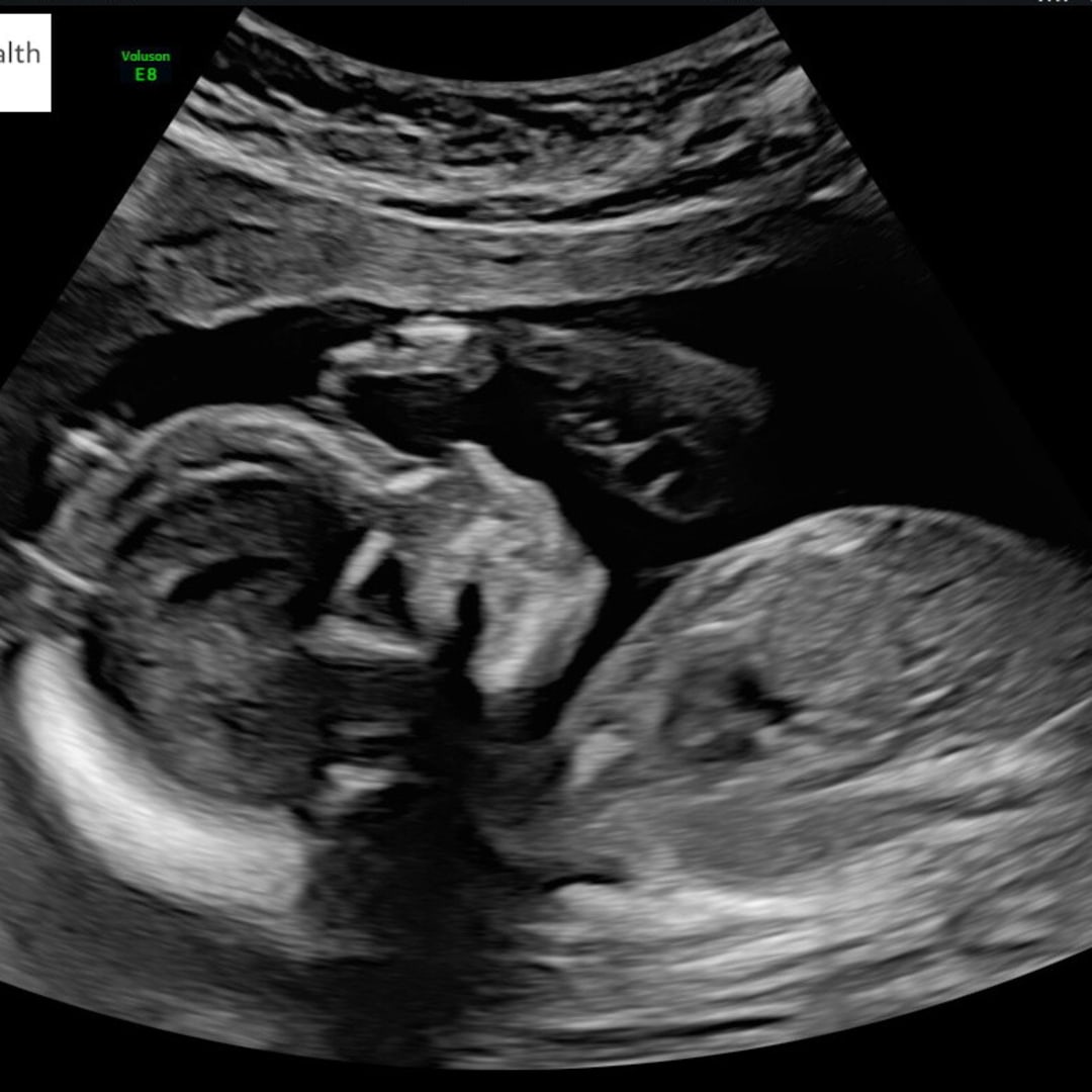 Photo shared by Alyssa for their Babylist baby registry.