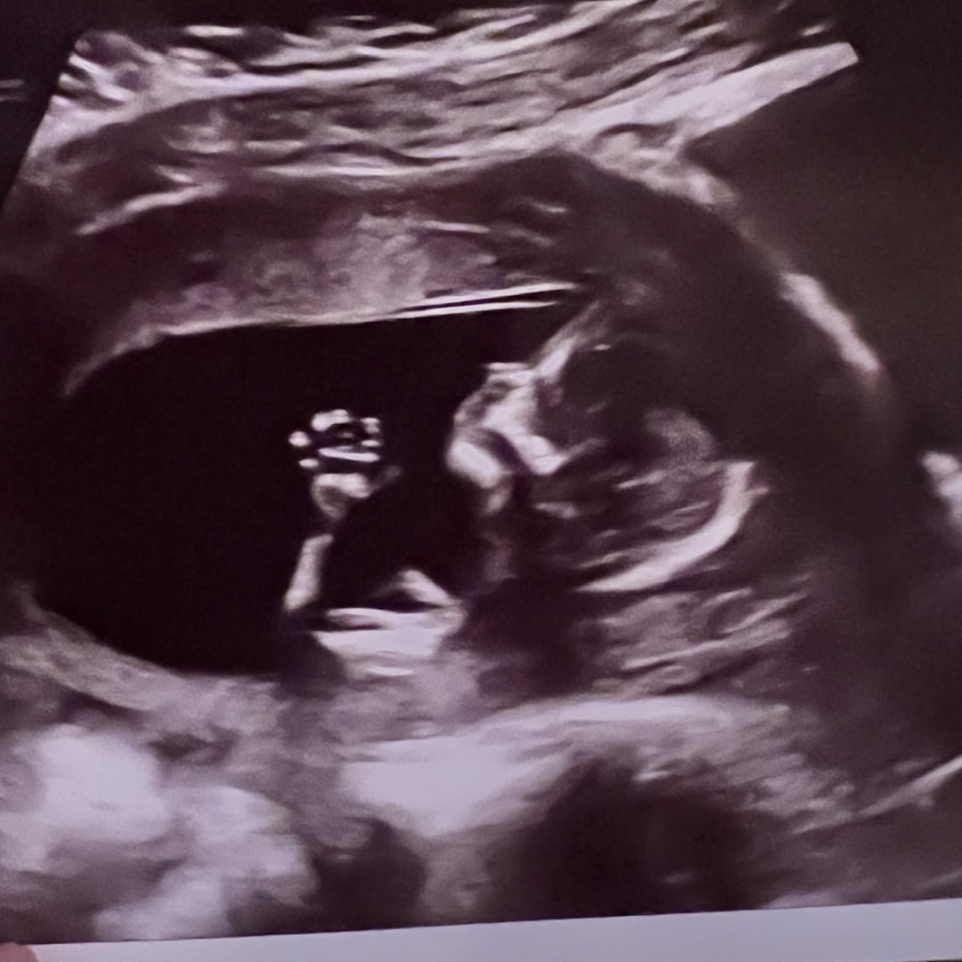 Photo shared by Molly for their Babylist baby registry.