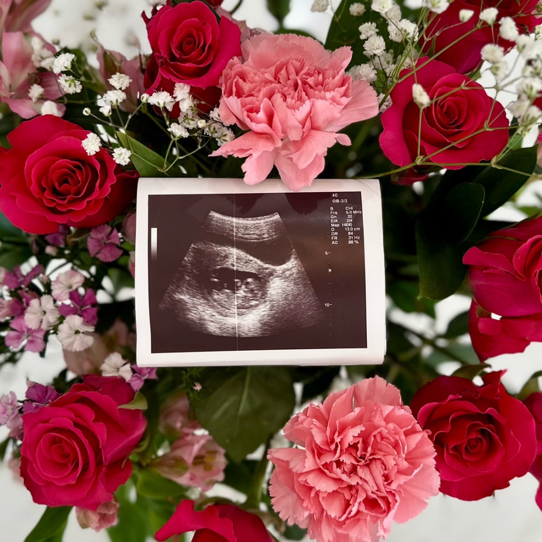 Photo shared by Lisette for their Babylist baby registry.