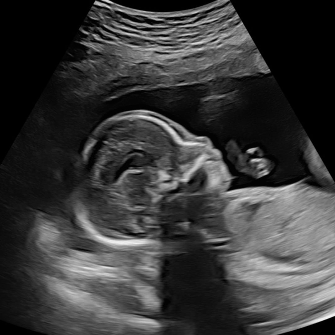 Photo shared by Michelle for their Babylist baby registry.