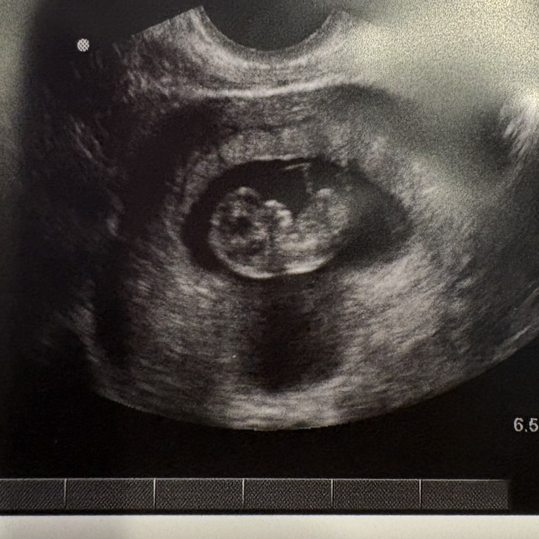 Photo shared by Tania for their Babylist baby registry.