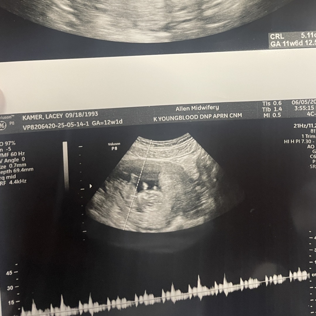 Photo shared by Lacey for their Babylist baby registry.