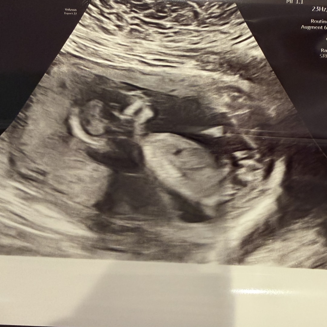 Photo shared by Madison for their Babylist baby registry.