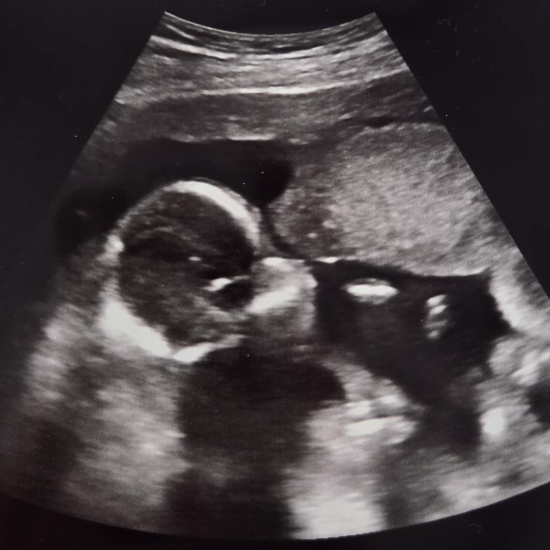 Photo shared by Becky for their Babylist baby registry.