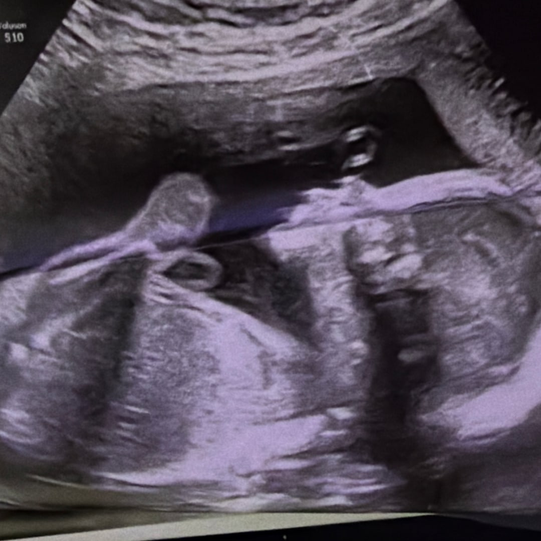 Photo shared by Jadalyn for their Babylist baby registry.