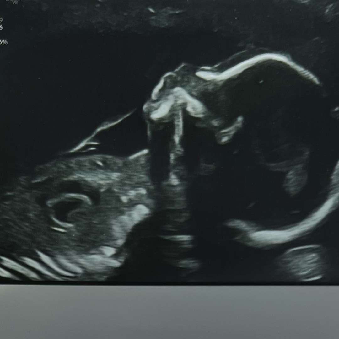 Photo shared by Monica for their Babylist baby registry.