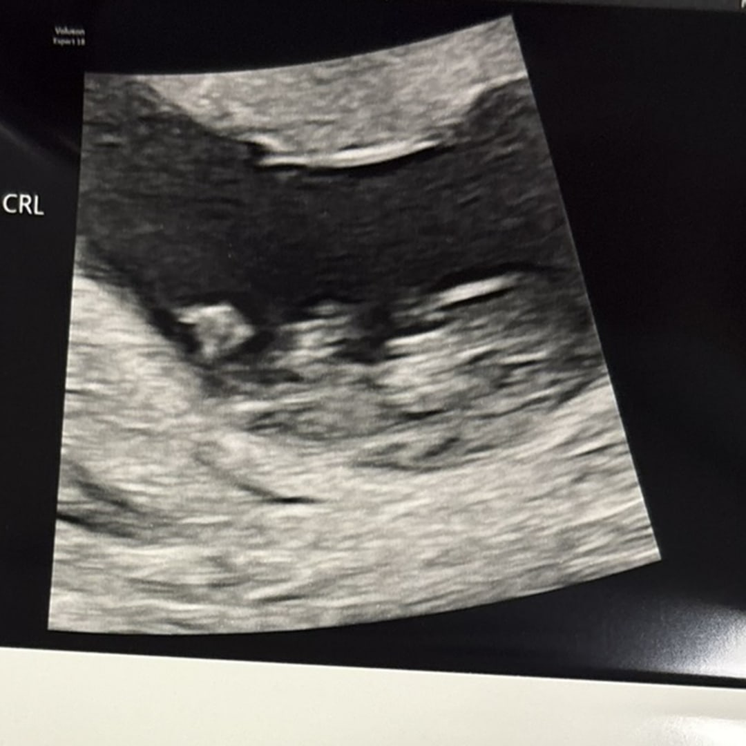 Photo shared by Sylvia for their Babylist baby registry.