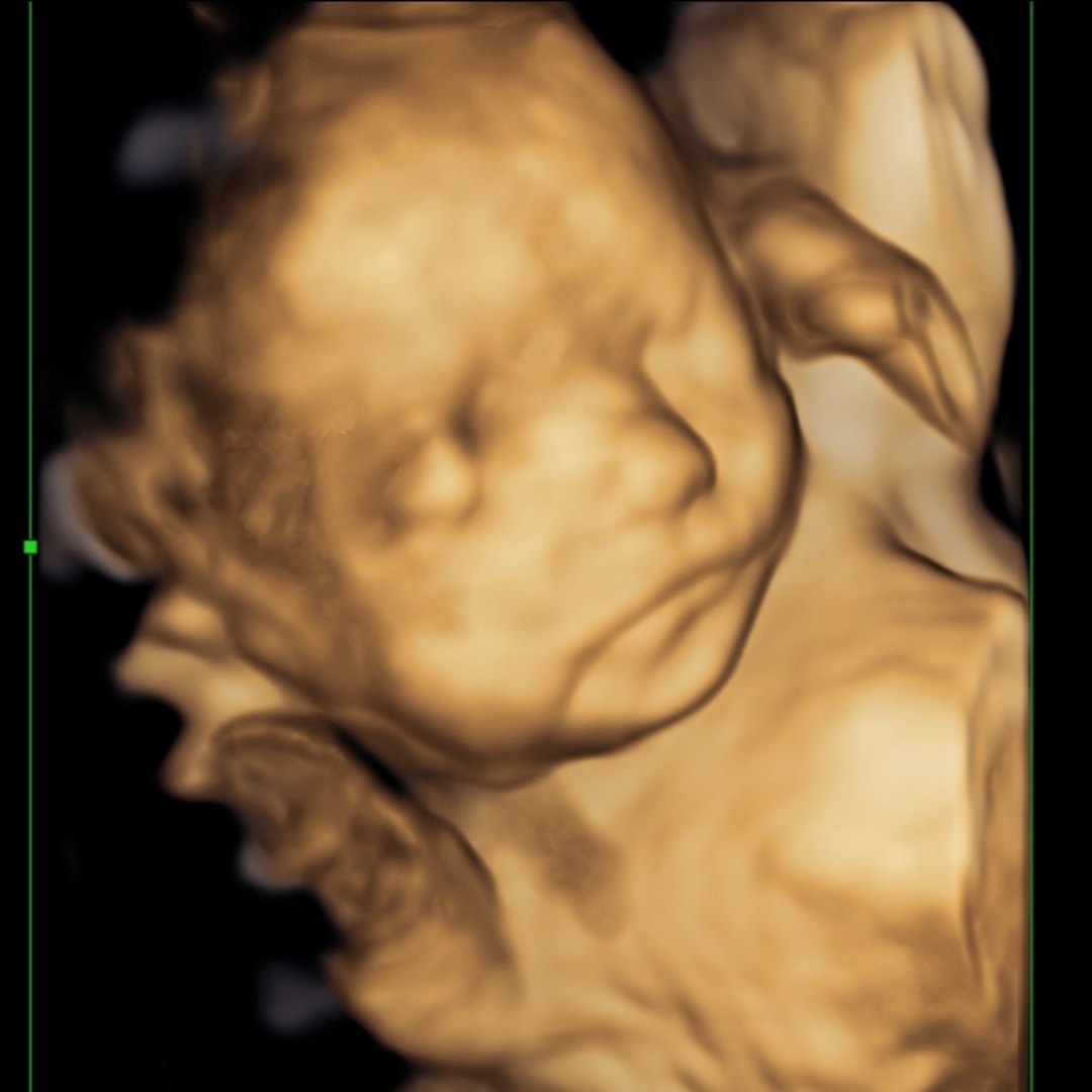 Photo shared by Amanda for their Babylist baby registry.