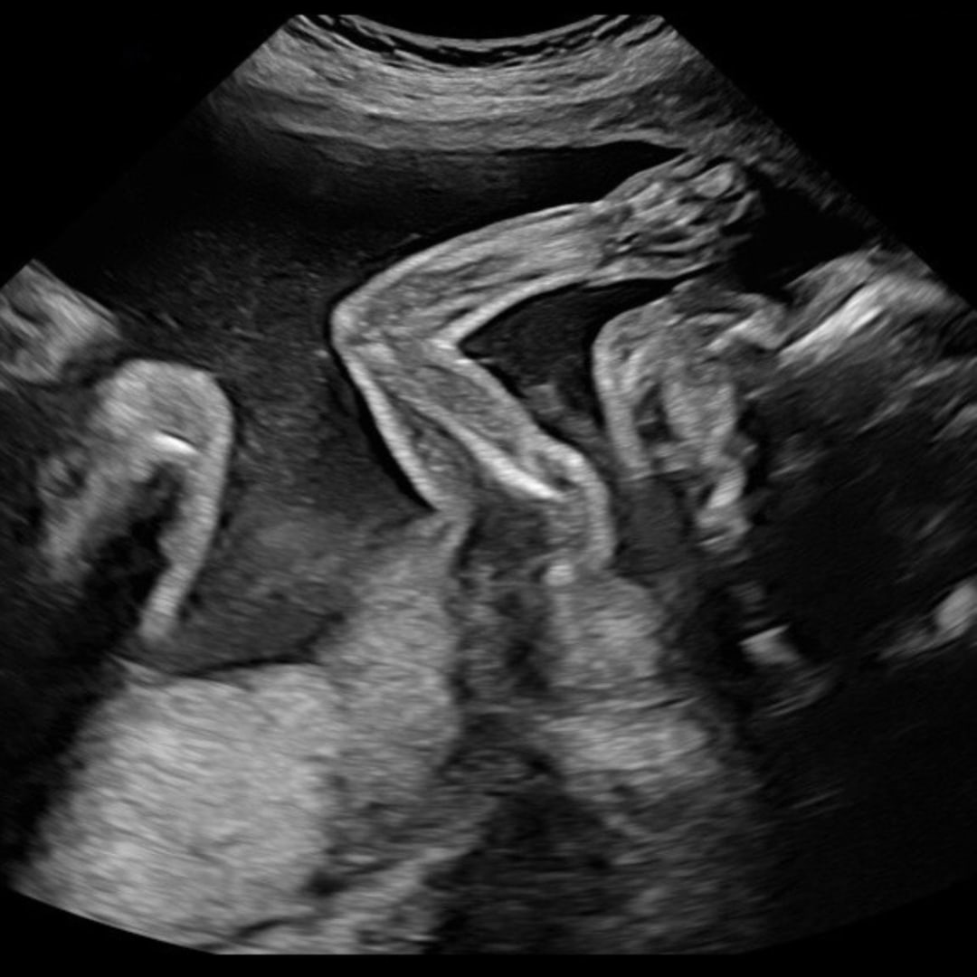 Photo shared by Emilee for their Babylist baby registry.