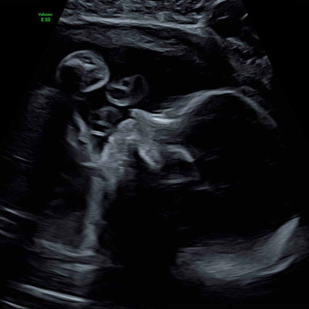 Photo shared by Leah for their Babylist baby registry.