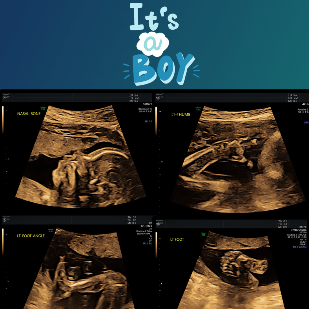 Photo shared by Lauryn for their Babylist baby registry.