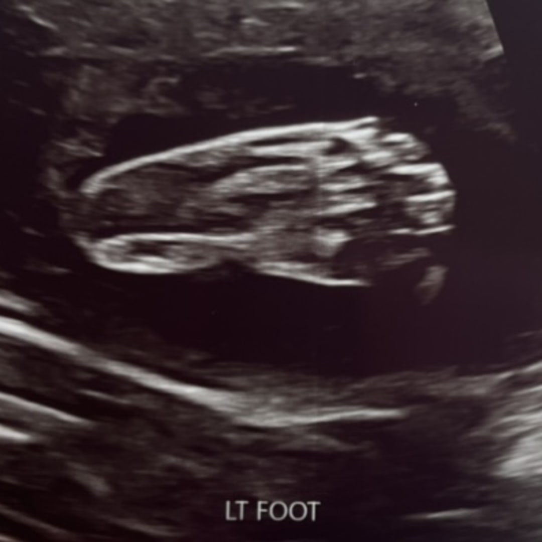 Photo shared by Alyssa for their Babylist baby registry.