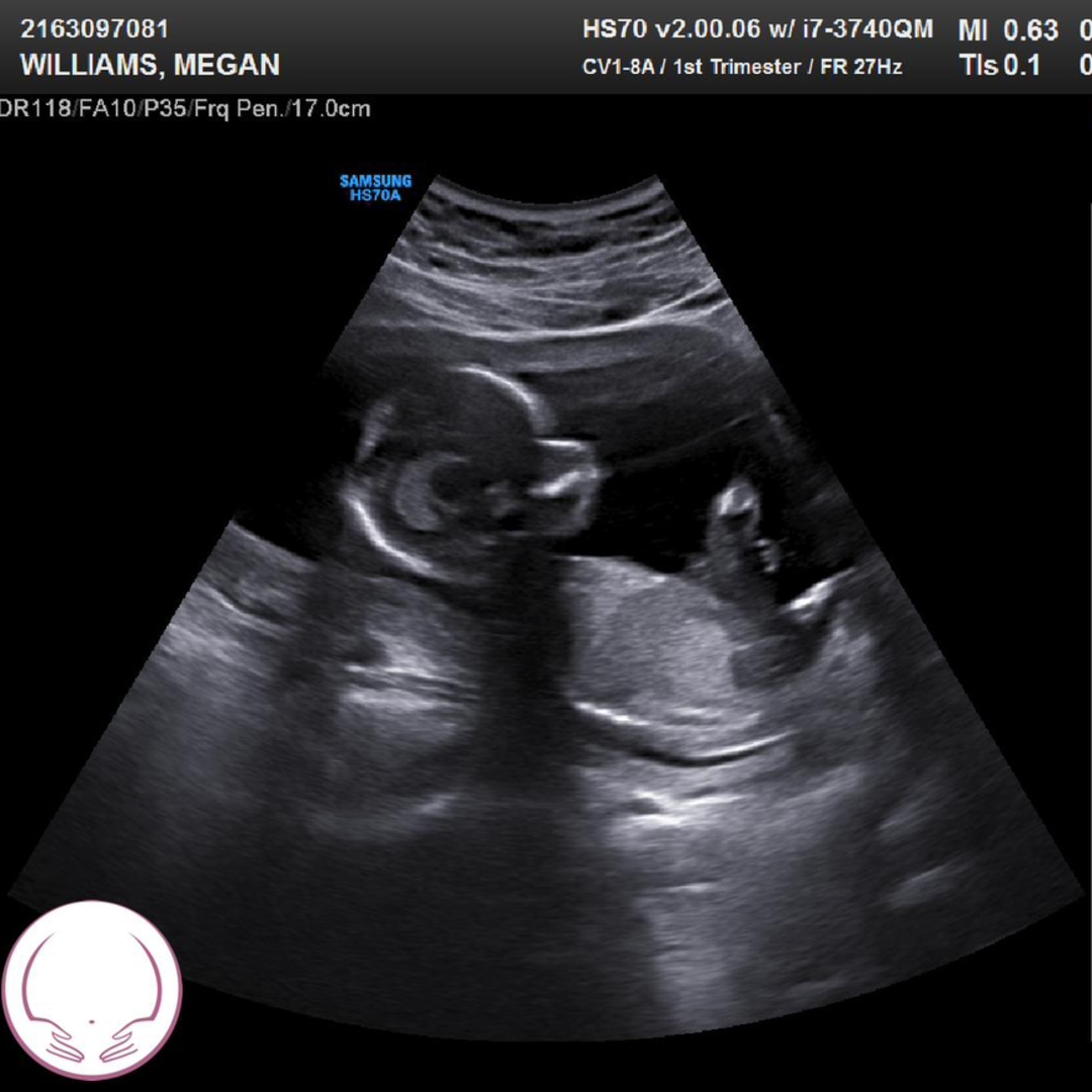 Photo shared by Megan for their Babylist baby registry.