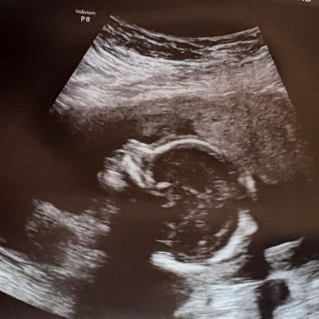 Photo shared by Laquitia for their Babylist baby registry.