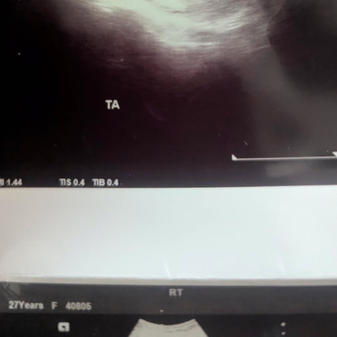 Photo shared by Makayla for their Babylist baby registry.