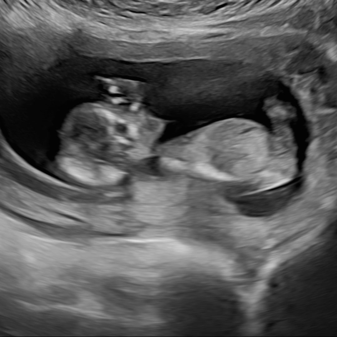 Photo shared by Danielle for their Babylist baby registry.
