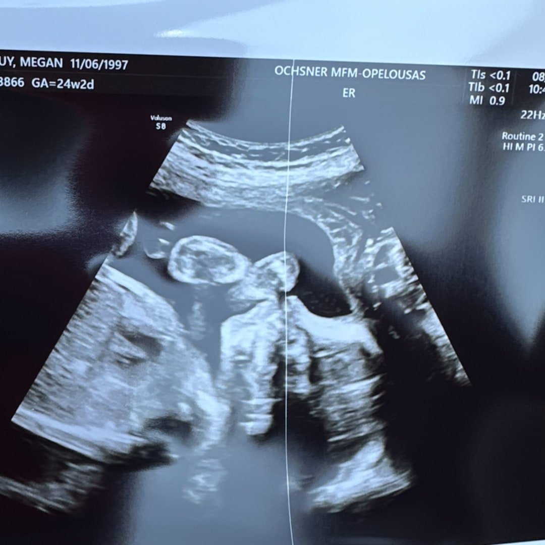 Photo shared by Megan for their Babylist baby registry.