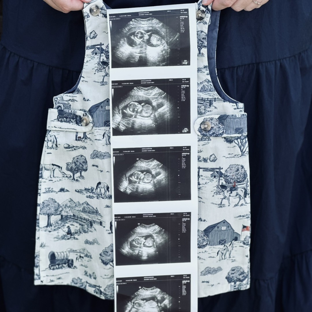 Photo shared by Kursten for their Babylist baby registry.