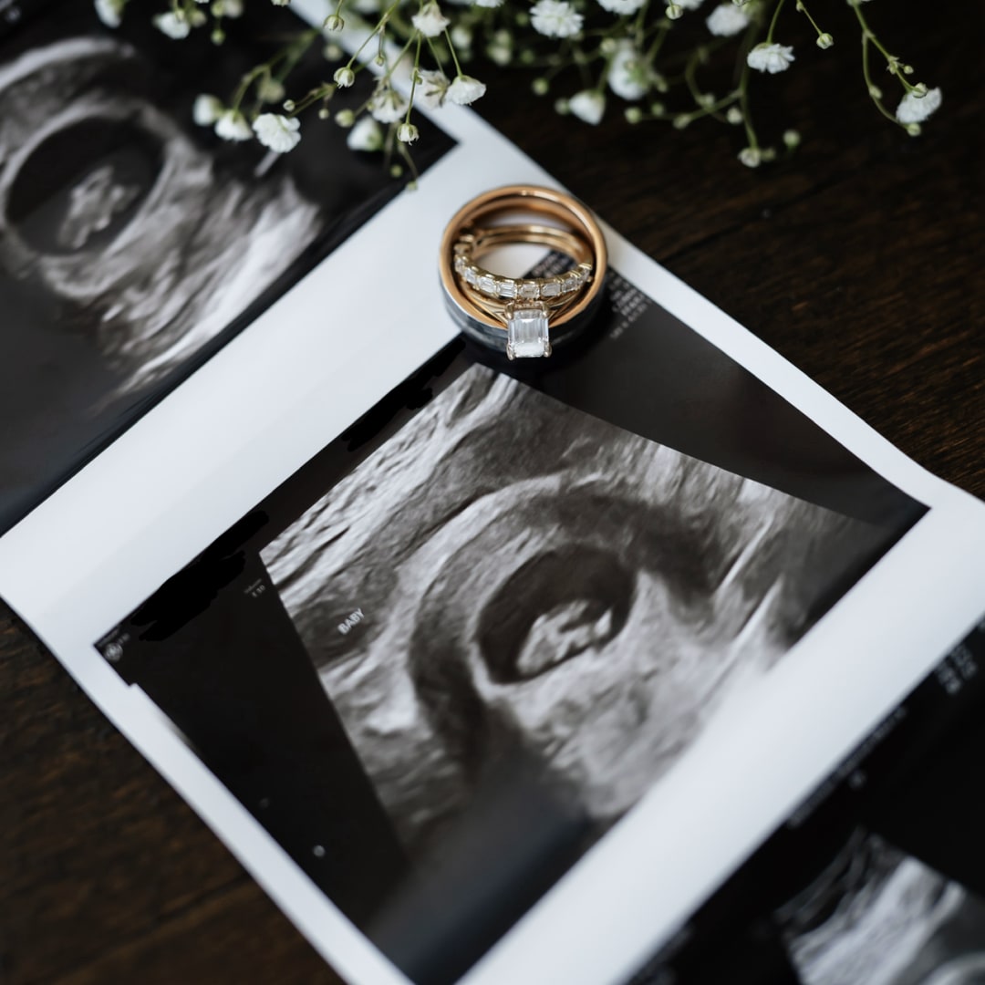 Photo shared by Hannah for their Babylist baby registry.