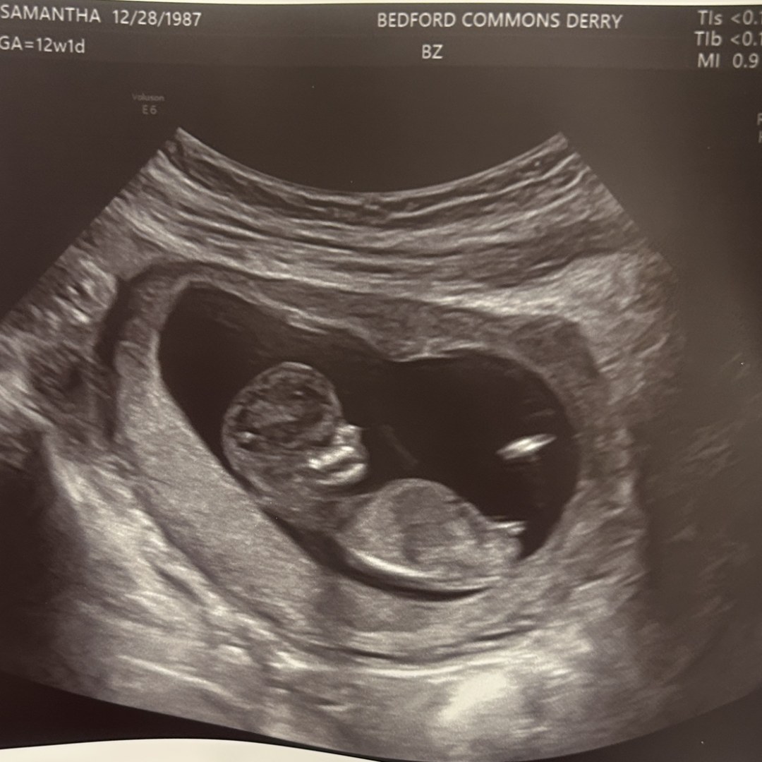 Photo shared by Samantha for their Babylist baby registry.