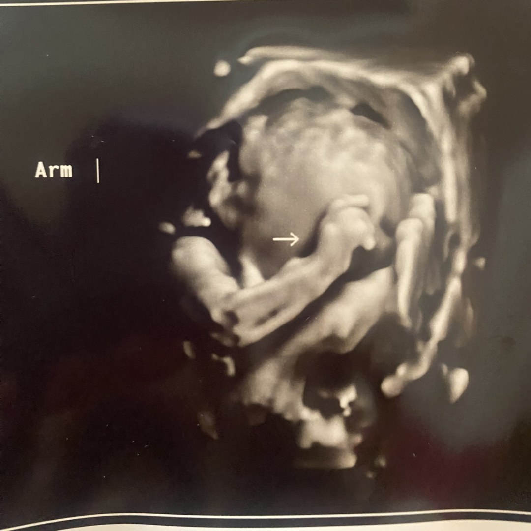 Photo shared by Laura for their Babylist baby registry.