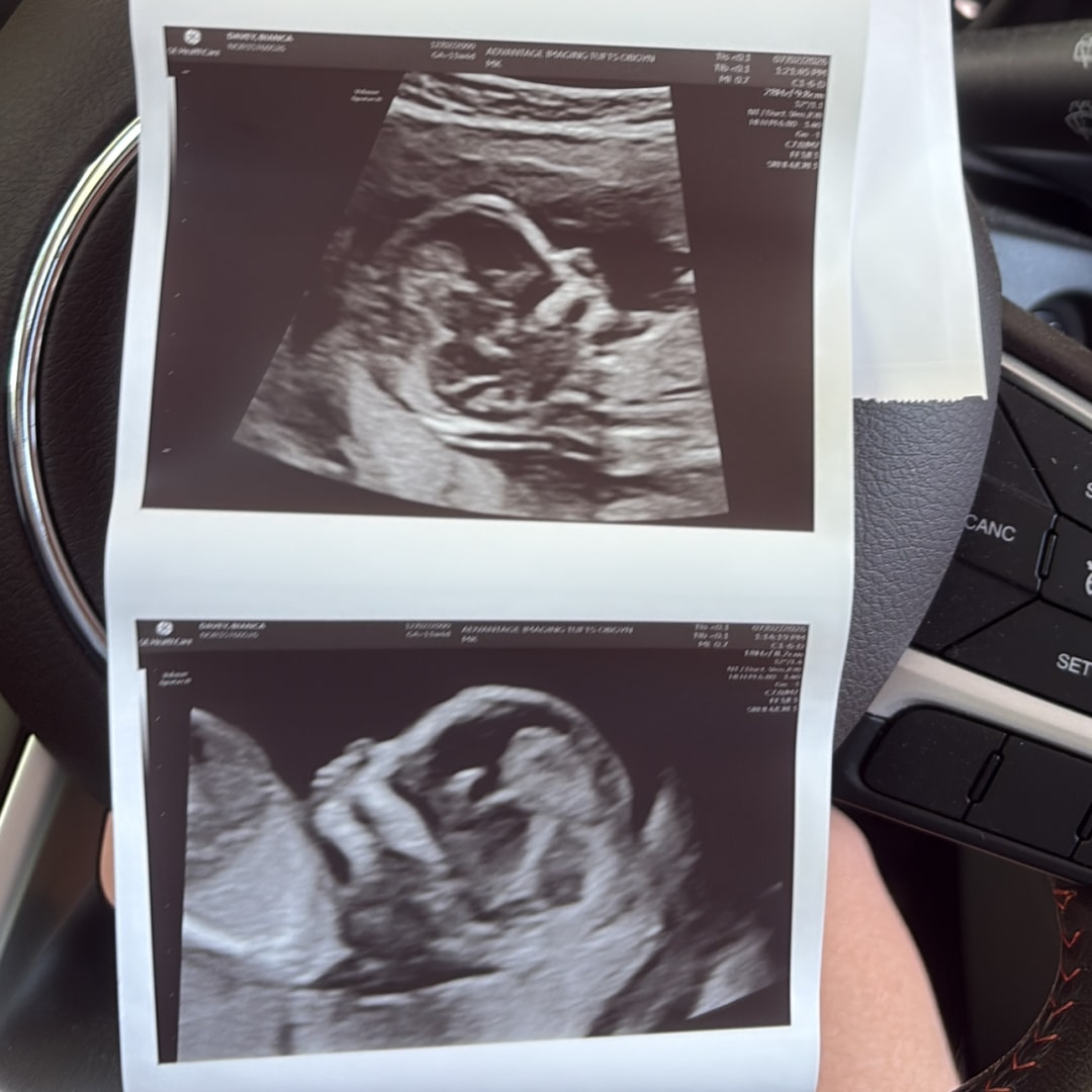 Photo shared by Bianca for their Babylist baby registry.