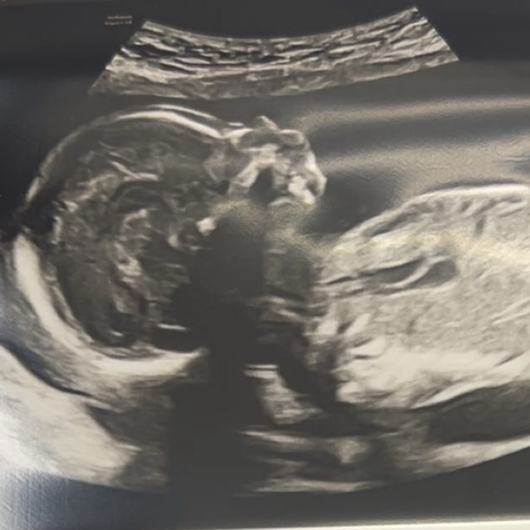 Photo shared by Amber for their Babylist baby registry.