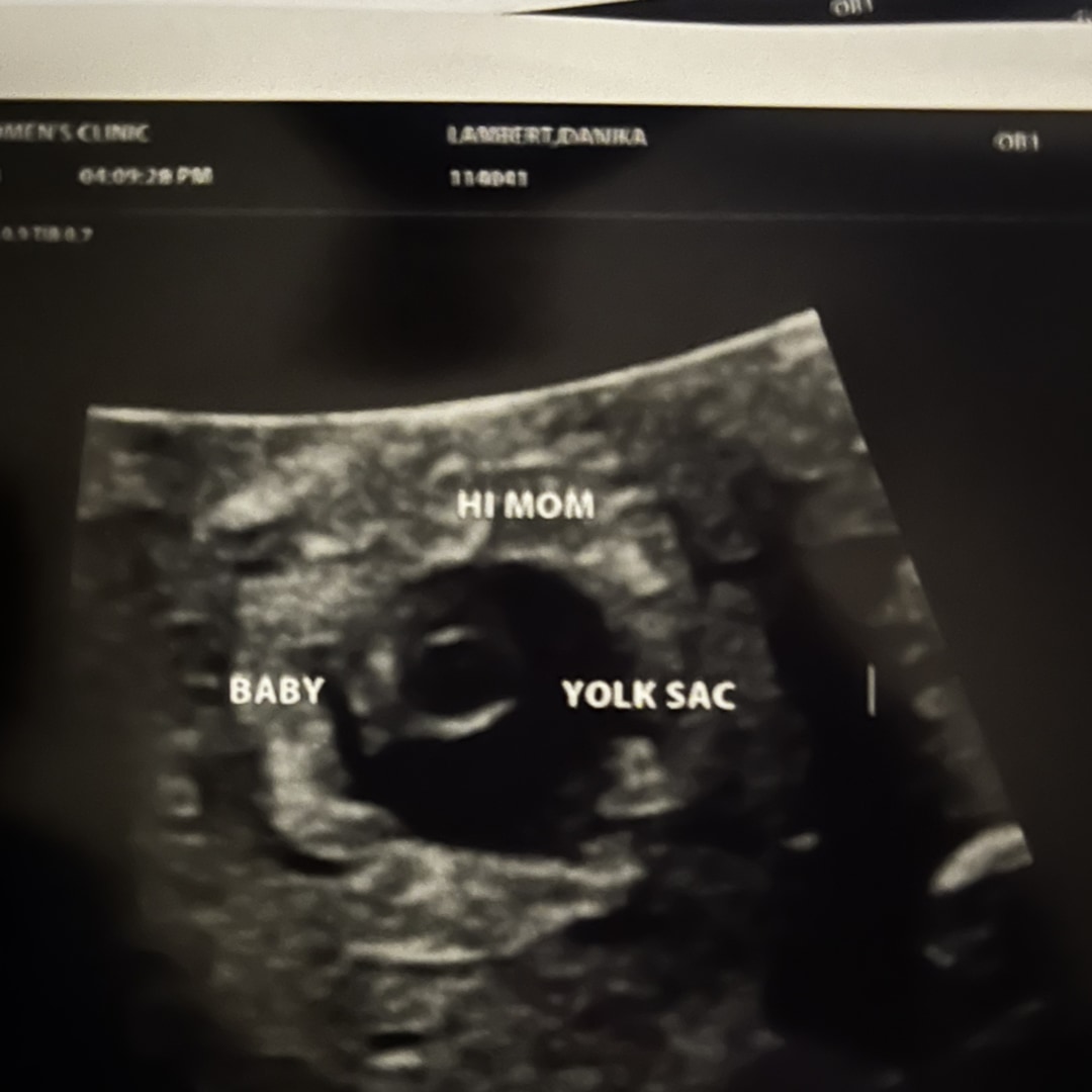 Photo shared by Danika for their Babylist baby registry.